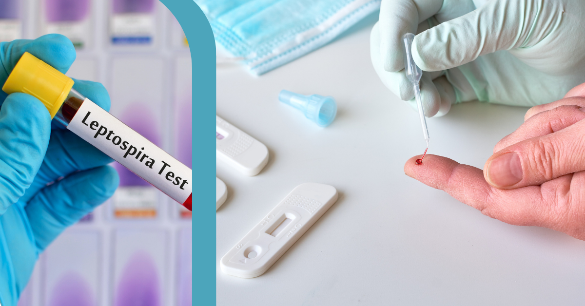 Leptospira Antibody Test