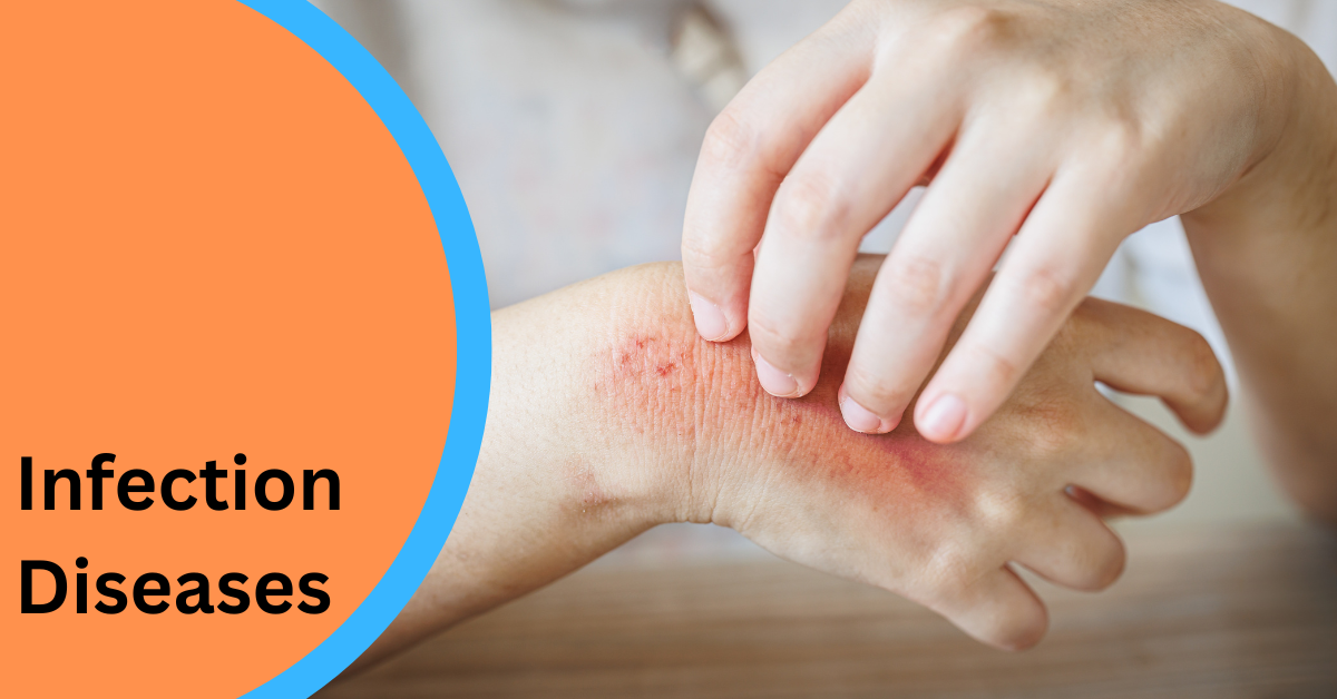 Infection Diseases